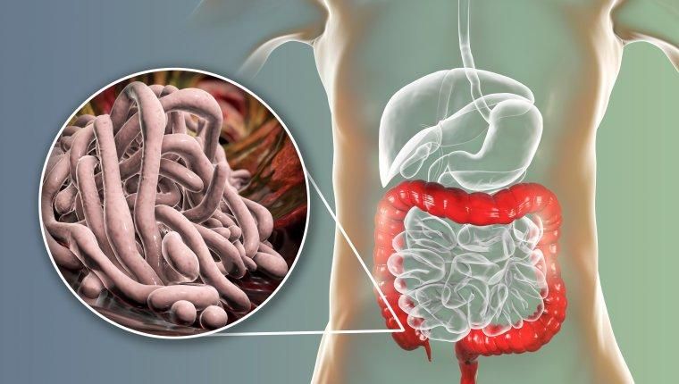 pasożyty w jelitach